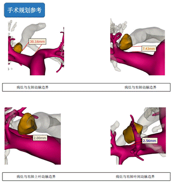 微信截图_20200624160057