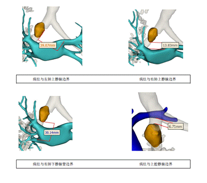 微信截图_20200624160146
